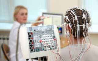 ЭЭГ при эпилепсии – особенности исследования и установка диагноза