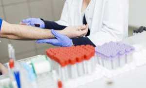 Как сдавать анализ крови на гепатит