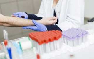 Как сдавать анализ крови на гепатит