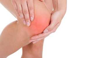 Как лечить растяжение связки коленного сустава