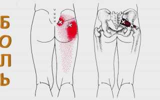 Что делать, когда болят ягодичные мышцы