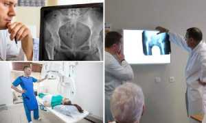 Как делают рентген тазобедренного сустава