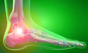 Как лечить артрит нижних конечностей