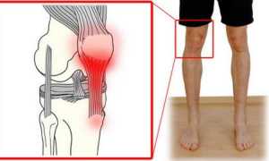 Как лечить тендиноз коленного и тазобедренного суставов