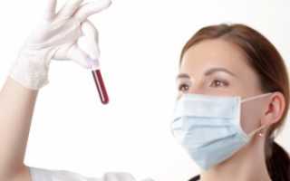 Назначение, правила сдачи крови на ХГЧ и расшифровка анализа
