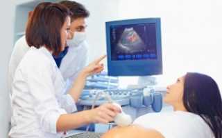 Расшифровка УЗИ первого триместра беременности: норма и патология плода