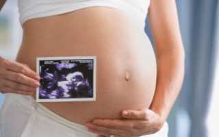 Нормы УЗИ по неделям беременности в таблице