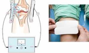 Как делают ультразвук с гидрокортизоном при заболевании суставов