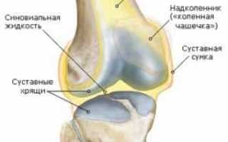 Что такое синовит коленного сустава и как его лечить