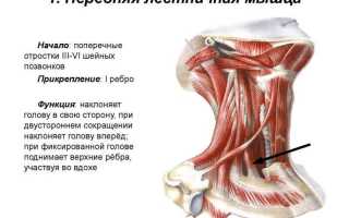 Как лечить синдром передней лестничной мышцы