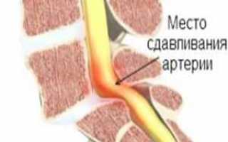 Может ли повышаться температура при остеохондрозе