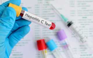 Клиника гепатита С – острая и хроническая формы и их особенности