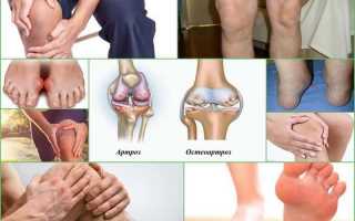 В чем разница артрита и артроза