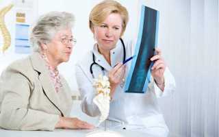 Как лечить остеопороз позвоночника