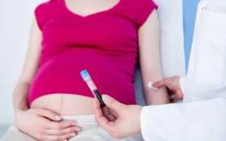 Анализ на ВИЧ при беременности: диагностика и расшифровка