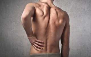 Как лечить синдром грушевидной мышцы