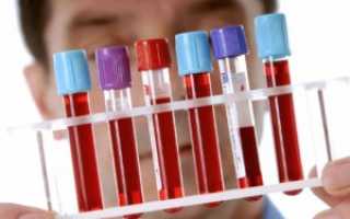 Общий анализ крови на NEU и его расшифровка