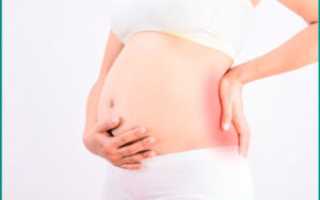 Камни в почках у беременных: последствия и лечение