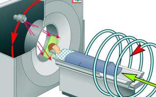 Что такое спиральная компьютерная томография