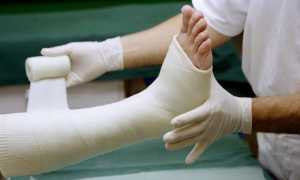 Как лечить перелом большого пальца ноги