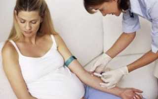 ТТГ при беременности повышен: признаки и опасность для плода