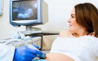 УЗИ с доплером при беременности – что это такое, подготовка и процедура обследования