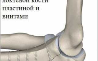 Как лечить перелом локтевого сустава