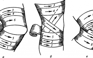 Как правильно сделать повязку на колено