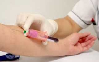 Как узнать уровень инсулина в крови и какая его норма?
