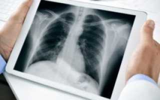 Бронхиальная астма – анализы и другие методы исследования, необходимые для постановки диагноза и оценки эффективности проводимого лечения