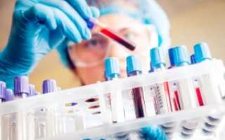 Гематологический анализ крови: нормы показателей в таблице