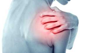 Как лечить тендинит плечевого сустава