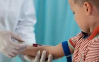 Тимоловая проба у детей: описание анализа, норма и отклонение от нормы