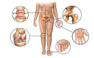 Какие БАДы можно принимать для суставов, связок и костей