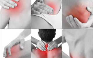 Как лечить миозит мышц спины
