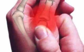 Что делать, если опух палец и болит