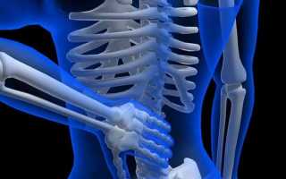 Как лечат спинальную мышечную атрофию