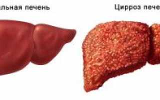 Показатели АЛТ и АСТ при гепатите