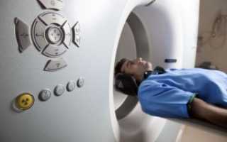 МРТ и компьютерная томография – Что лучше?