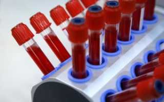 Биохимические анализы крови: расшифровка по таблице основных значений