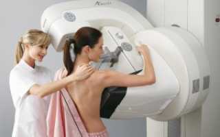Маммография – что это за метод диагностики?