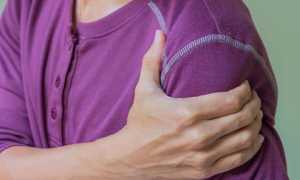 Как лечить плексит плечевого сустава