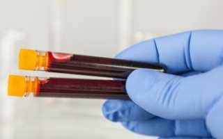 Анализ крови на прогестерон и его расшифровка