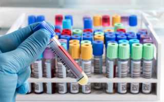 Биохимический анализ крови – что входит в исследование и о чем оно может рассказать?