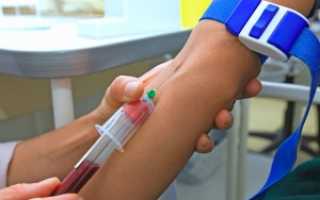 КСР анализ крови: что это и когда сдается