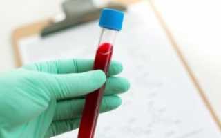 Расшифровка основных показателей анализа крови из вены