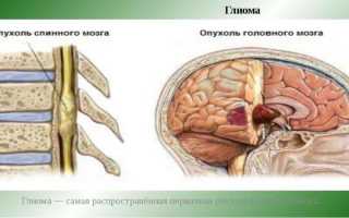 Как лечить рак спинного мозга