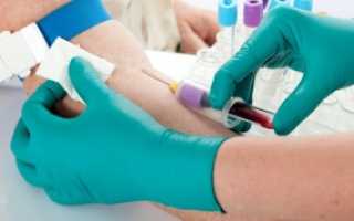 Кровь на РВ сдается натощак: основные рекомендации к подготовке перед анализом
