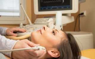 Ультразвуковое дуплексное сканирование брахиоцефальных артерий: назначение, процедура и расшифровка