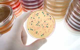 Бактериологический метод исследования в микробиологии – важность метода и основные этапы